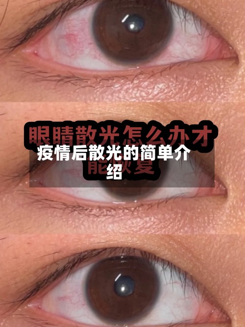 疫情后散光的简单介绍-第2张图片