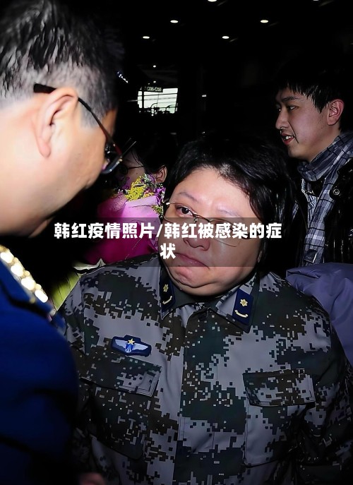 韩红疫情照片/韩红被感染的症状